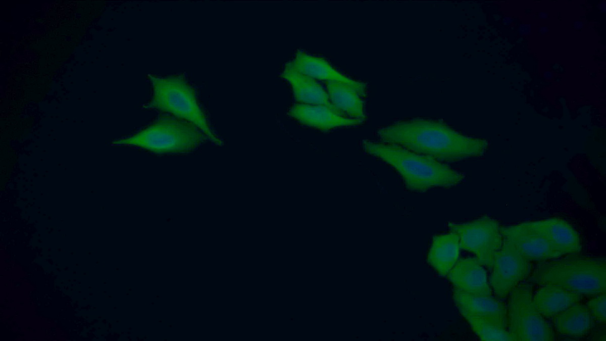 Polyclonal Antibody to Glutathione S Transferase Pi (GSTp)