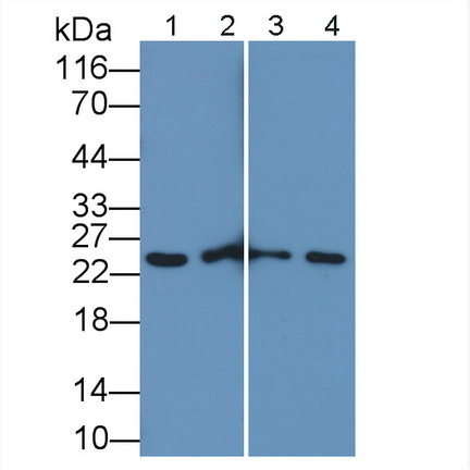 Polyclonal Antibody to Glutathione S Transferase Pi (GSTp)