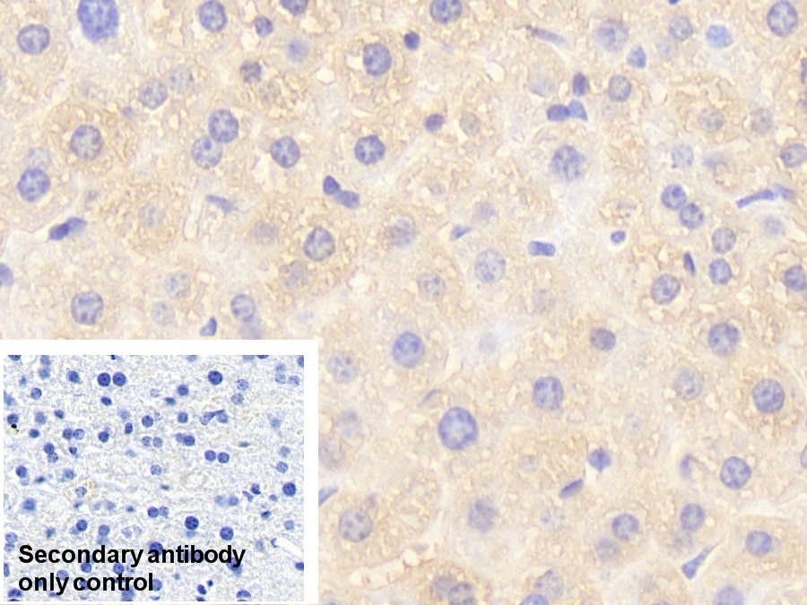 Polyclonal Antibody to Glutathione S Transferase Pi (GSTp)