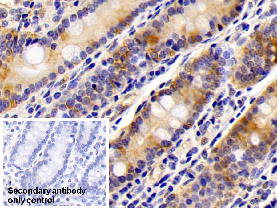 Polyclonal Antibody to Glutathione S Transferase Pi (GSTp)