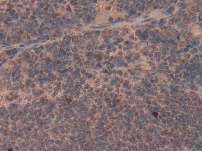 Polyclonal Antibody to Glutathione S Transferase Pi (GSTp)