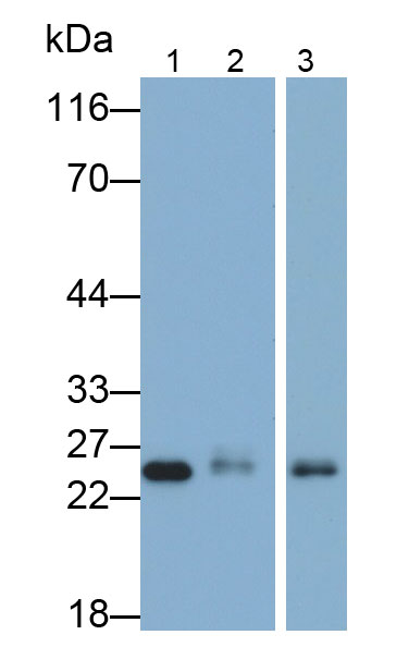 Polyclonal Antibody to Glutathione S Transferase Pi (GSTp)