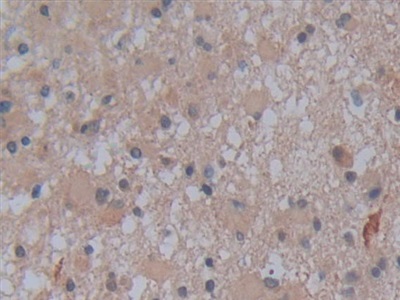 Polyclonal Antibody to Alkaline Phosphatase, Tissue-nonspecific (ALPL)