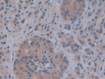 Polyclonal Antibody to Alkaline Phosphatase, Tissue-nonspecific (ALPL)