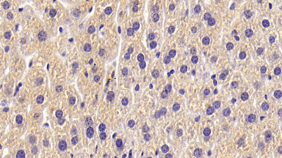 Polyclonal Antibody to Alkaline Phosphatase, Tissue-nonspecific (ALPL)