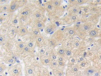 Polyclonal Antibody to Brain Finger Protein (BFP)