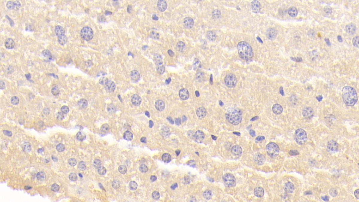 Polyclonal Antibody to Brain Finger Protein (BFP)