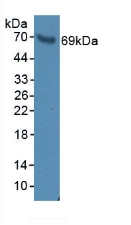 Polyclonal Antibody to Brain Finger Protein (BFP)