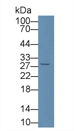 Polyclonal Antibody to Cluster Of Differentiation 8a (CD8a)