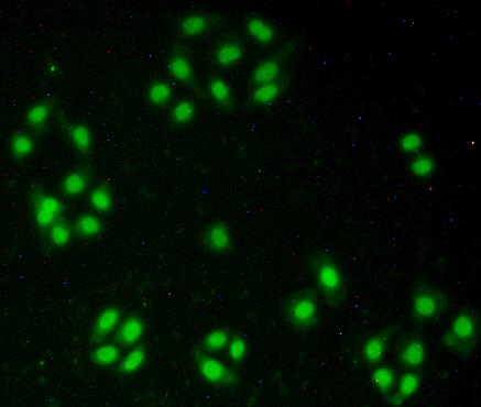 Polyclonal Antibody to Nucleoporin 50kDa (NUP50)