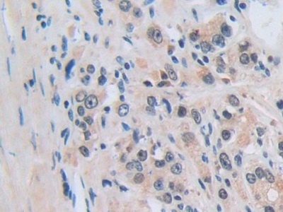 Polyclonal Antibody to Nucleoporin 50kDa (NUP50)