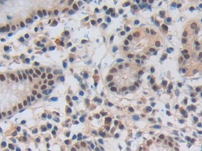 Polyclonal Antibody to Nucleoporin 50kDa (NUP50)