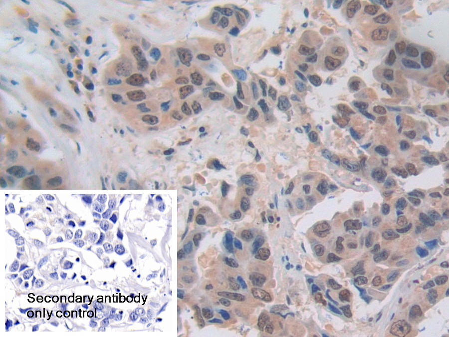 Polyclonal Antibody to Nucleoporin 50kDa (NUP50)