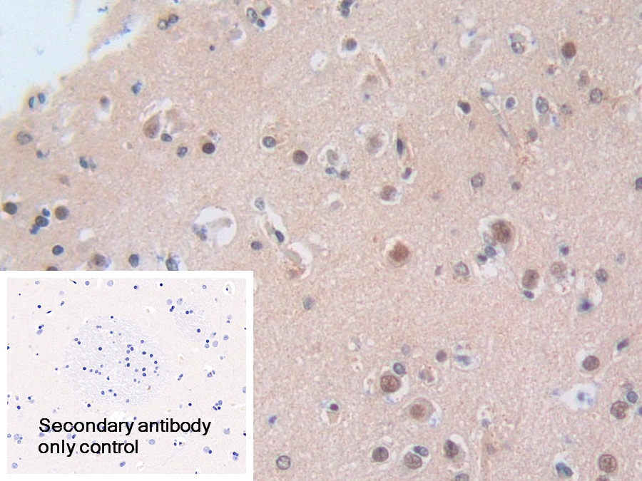 Polyclonal Antibody to Nucleoporin 50kDa (NUP50)