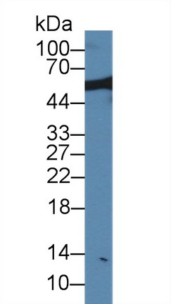 Polyclonal Antibody to Nucleoporin 50kDa (NUP50)