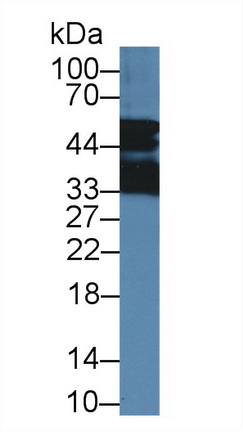 Polyclonal Antibody to Nucleoporin 50kDa (NUP50)