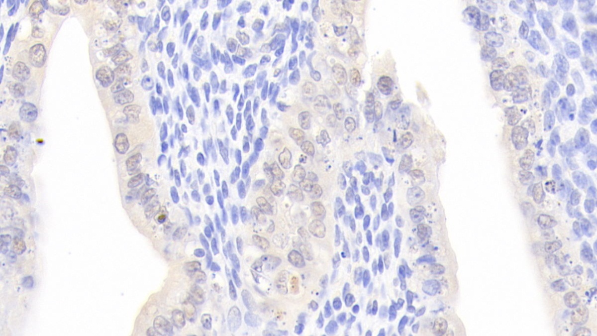 Polyclonal Antibody to Nucleoporin 50kDa (NUP50)