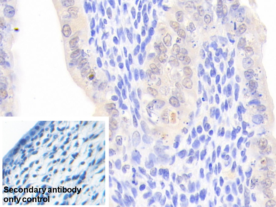 Polyclonal Antibody to Nucleoporin 50kDa (NUP50)