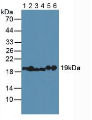 Polyclonal Antibody to Myosin Light Chain 2 (MYL2)