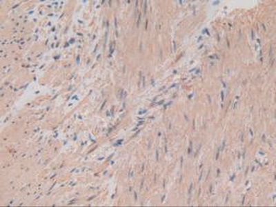 Polyclonal Antibody to Myosin Light Chain 2 (MYL2)