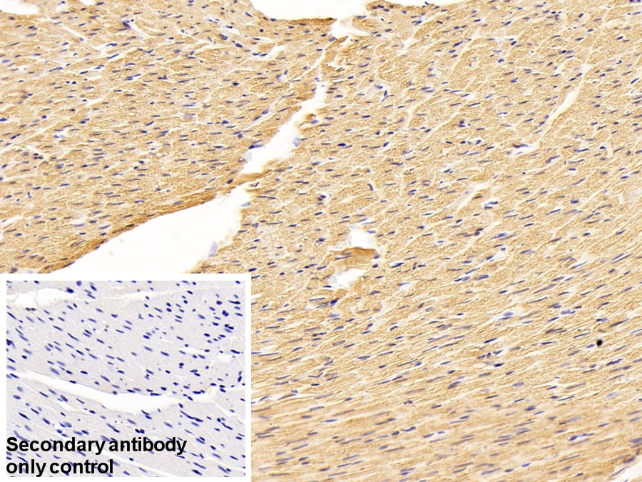 Polyclonal Antibody to Myosin Light Chain 2 (MYL2)