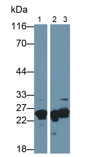 Polyclonal Antibody to Myosin Light Chain 1 (MYL1)