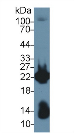 Polyclonal Antibody to Myosin Light Chain 1 (MYL1)