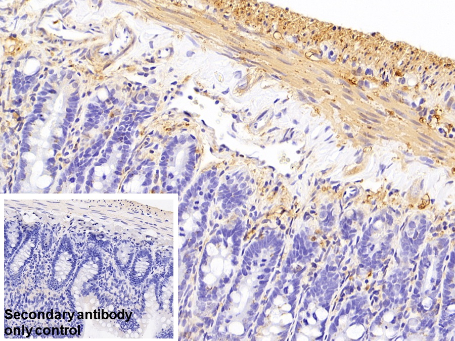 Polyclonal Antibody to Myosin Light Chain Kinase (MYLK)