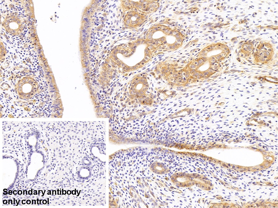 Polyclonal Antibody to Myosin Light Chain Kinase (MYLK)