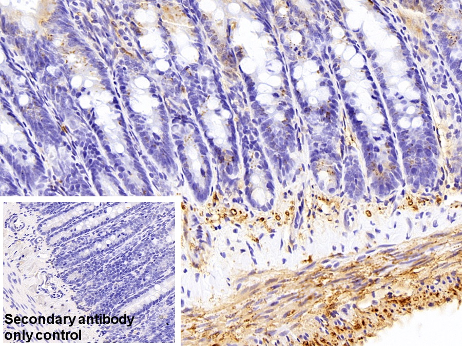 Polyclonal Antibody to Myosin Light Chain Kinase (MYLK)