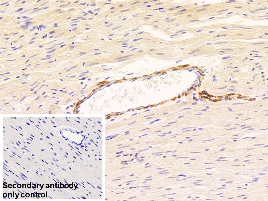 Polyclonal Antibody to Myosin Light Chain Kinase (MYLK)