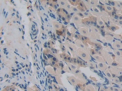 Polyclonal Antibody to Nucleoporin 85 (NUP85)