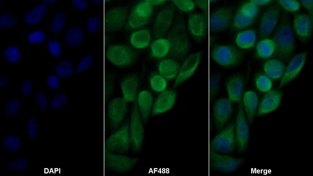 Polyclonal Antibody to Nucleoporin 85 (NUP85)