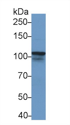 Polyclonal Antibody to Nucleoporin 107kDa (NUP107)