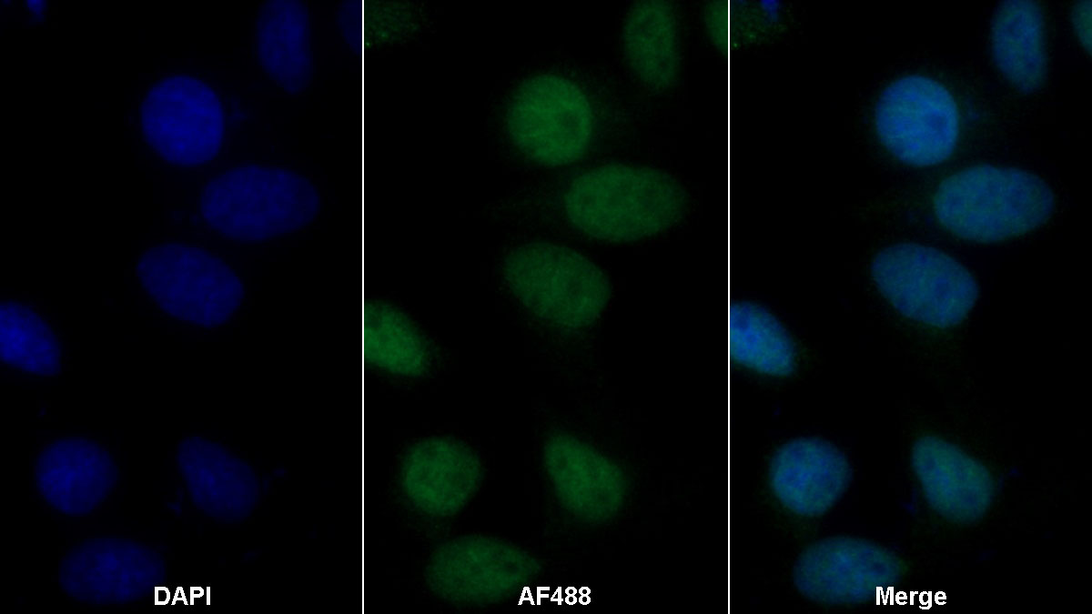 Polyclonal Antibody to Complement Component 1, R Subcomponent (C1r)