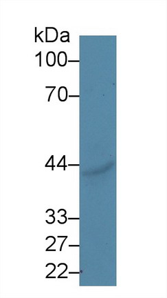 Polyclonal Antibody to Ectonucleoside Triphosphate Diphosphohydrolase 1 (ENTPD1)