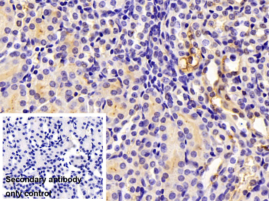 Polyclonal Antibody to Arginase (ARG)