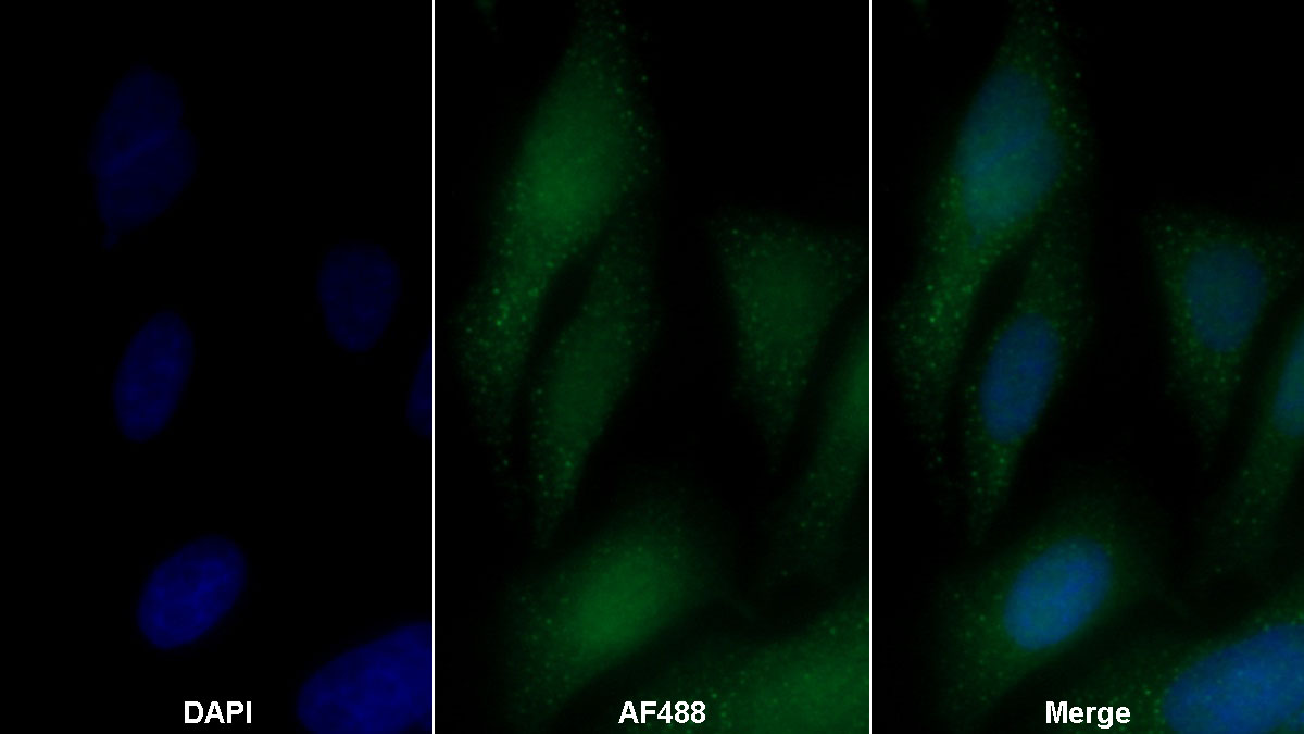 Polyclonal Antibody to Arginase (ARG)