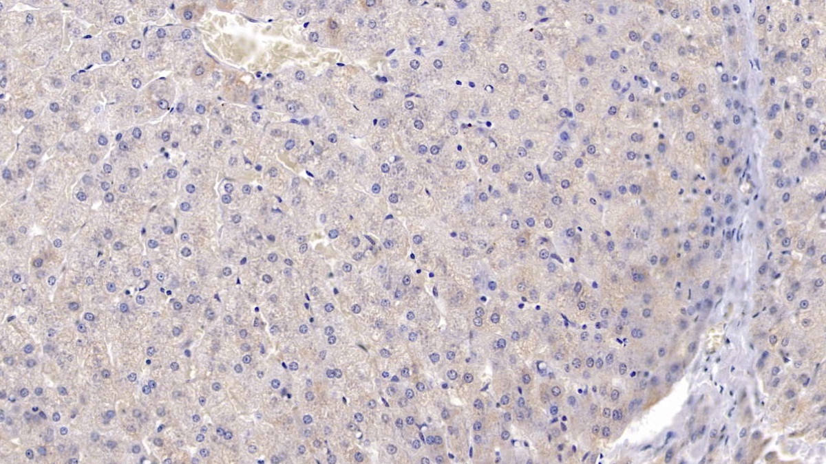 Polyclonal Antibody to Complement Receptor 1, Erythrocyte (CR1)