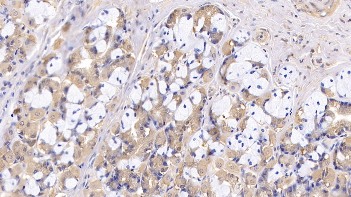 Polyclonal Antibody to Complement Receptor 1, Erythrocyte (CR1)