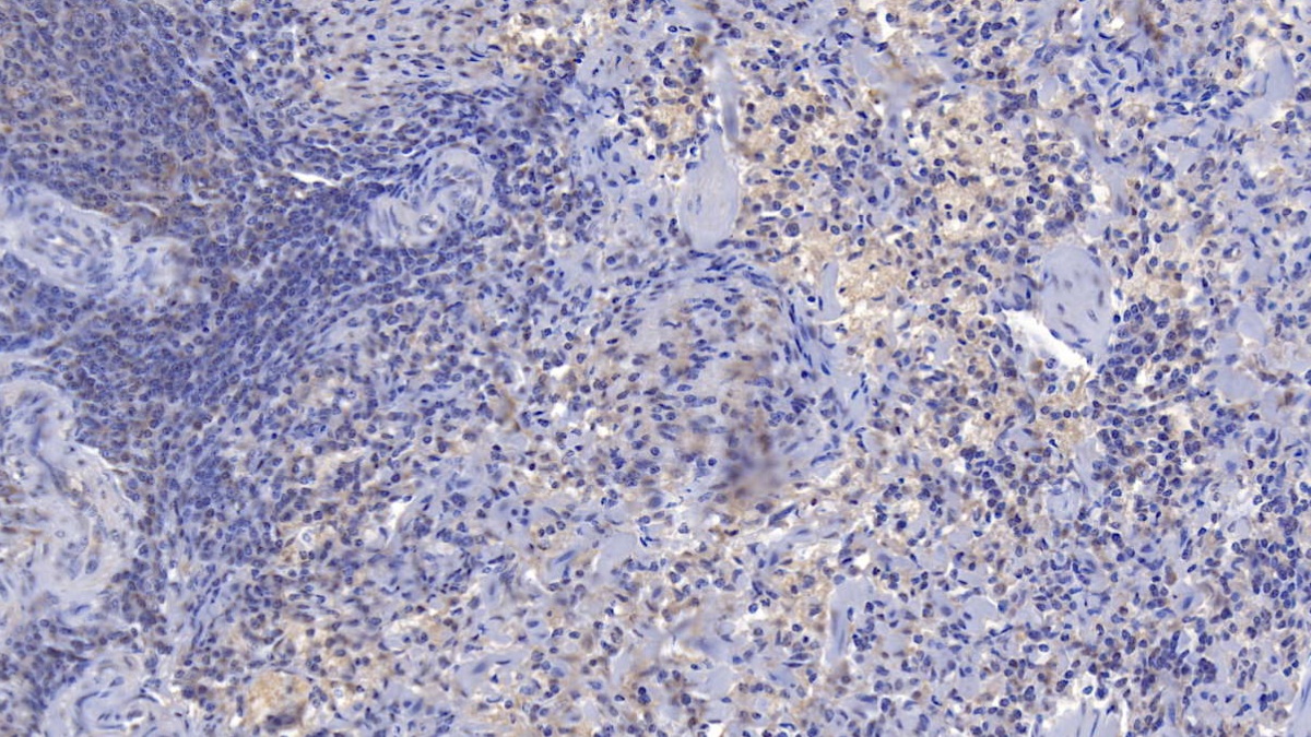 Polyclonal Antibody to Complement Receptor 1, Erythrocyte (CR1)