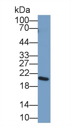 Polyclonal Antibody to Deoxyribonuclease I (DNASE1)