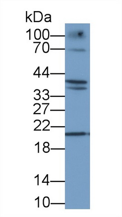 Polyclonal Antibody to Deoxyribonuclease I (DNASE1)