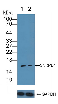 Polyclonal Antibody to Small Nuclear Ribonucleoprotein Polypeptide D1 (SNRPD1)