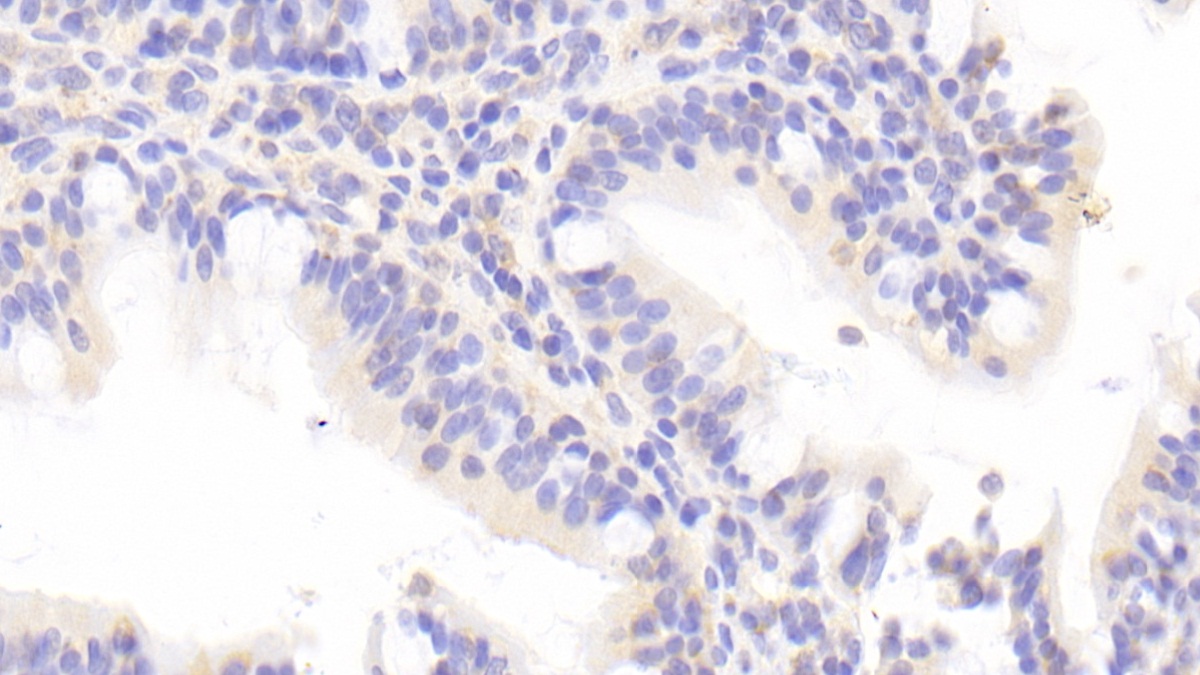 Polyclonal Antibody to Chemokine C-C-Motif Ligand 1 (CCL1)