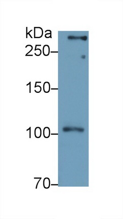 Polyclonal Antibody to Chondroitin Sulfate Proteoglycan 4 (CSPG4)