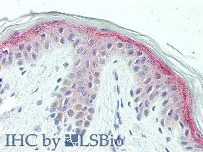 Polyclonal Antibody to Chondroitin Sulfate Proteoglycan 4 (CSPG4)