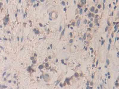 Polyclonal Antibody to Structural Maintenance Of Chromosomes Protein 3 (SMC3)