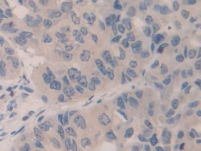 Polyclonal Antibody to Structural Maintenance Of Chromosomes Protein 3 (SMC3)