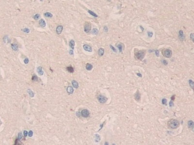 Polyclonal Antibody to Structural Maintenance Of Chromosomes Protein 3 (SMC3)